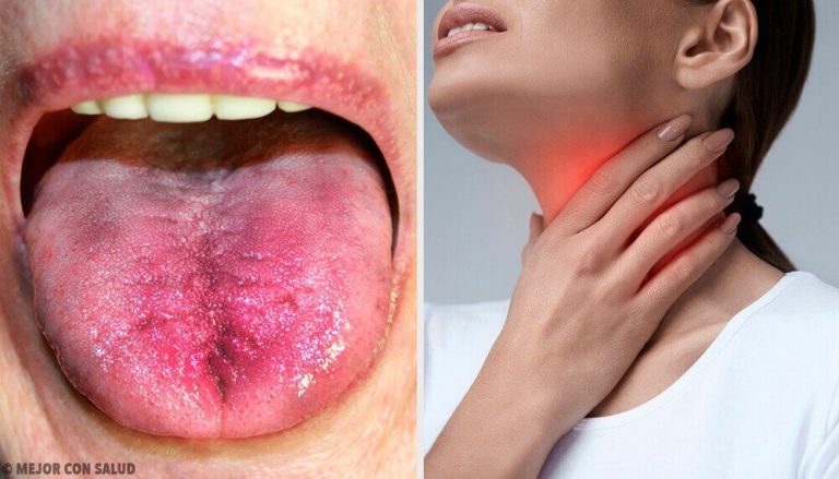 6種知道你的喉嚨裡是否有斑塊的方法