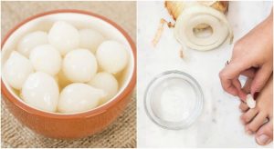 腳上長繭嗎?用這種100%天然的方法擺脫它