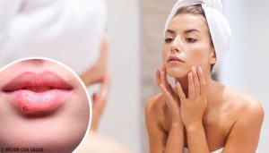 13個可能是健康問題的臉部徵兆