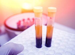 你需要增加血小板值嗎?這四種療法會有幫助喔!