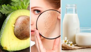 10種滋潤乾燥肌膚的最佳自製療方