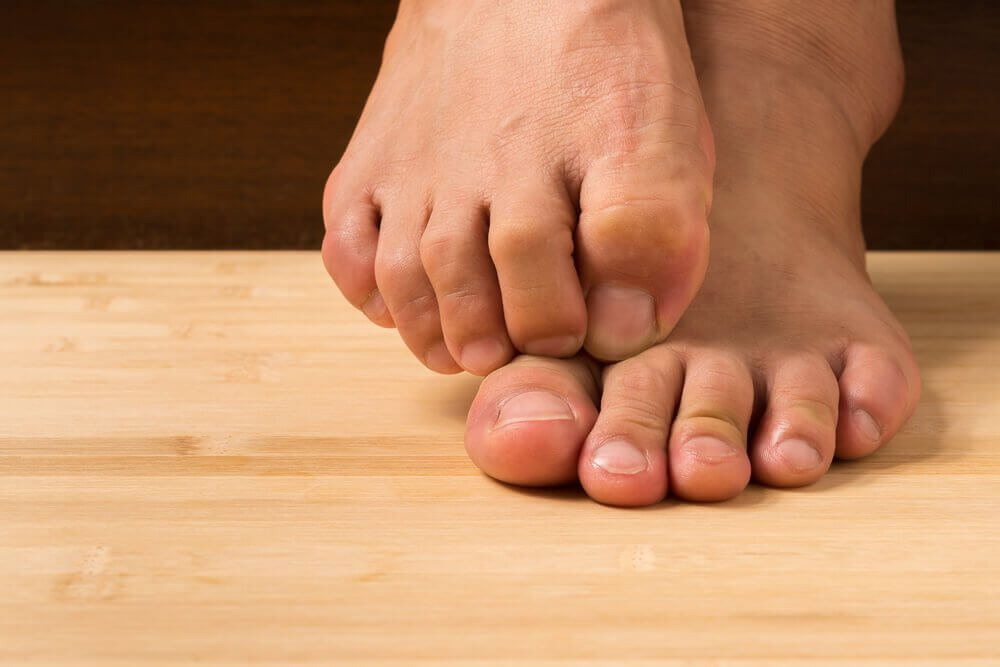真菌的療法:如何用天然成份治療