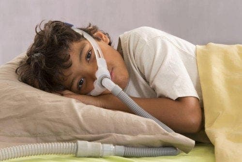 兒童的阻塞性睡眠呼吸中止症