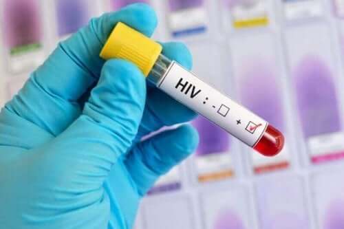 HIV血液檢查
