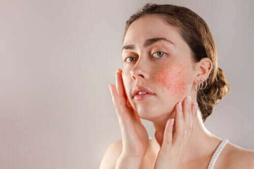 反應性肌膚：症狀、原因和治療