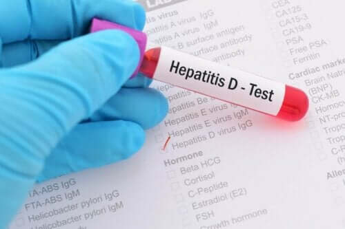 D型肝炎測試