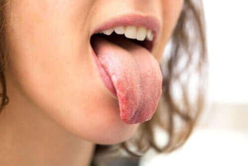 糖尿病患者為什麼會出現口腔乾燥？